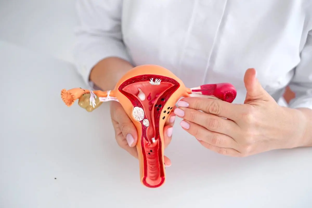 La consulta: endometriosis, dolor menstrual incapacitante