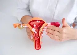 La consulta: endometriosis, dolor menstrual incapacitante