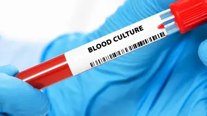 Suben a ocho las muertes en Estados Unidos por una bacteria carn&iacute;vora presente en el mar