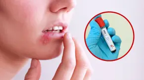Un virus que no se cura: ¿Cómo se transmite el  herpes simple?