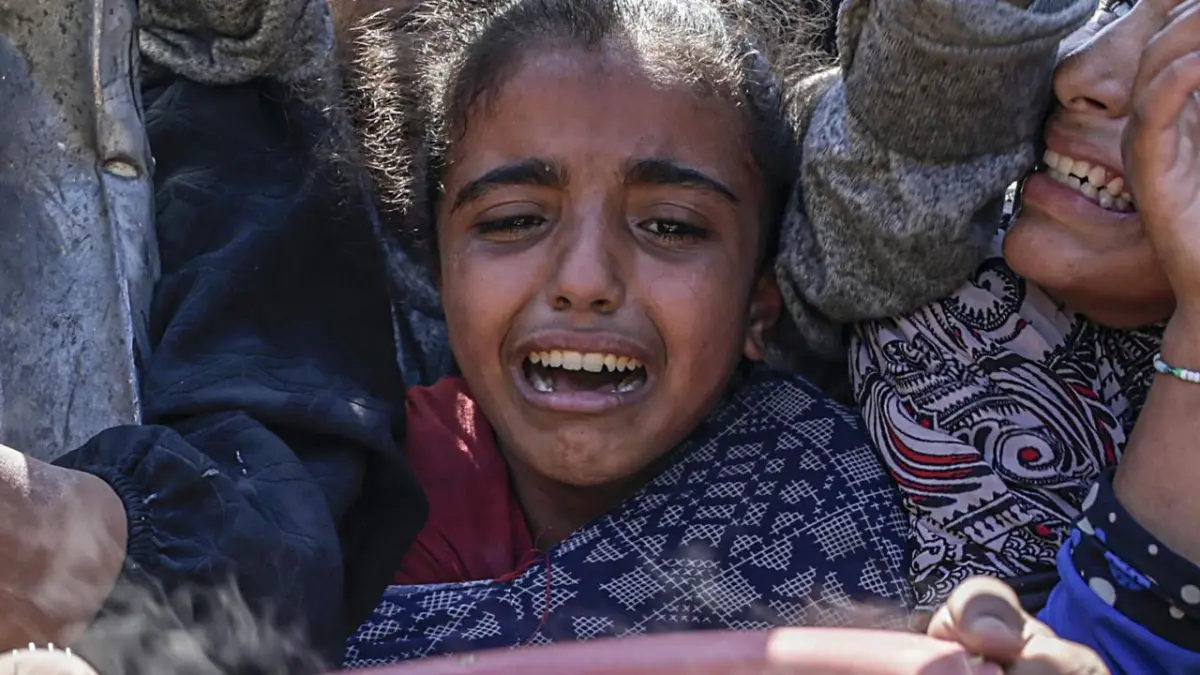 Los muertos por desnutrición en Gaza superan los 200, casi la mitad niños