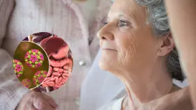 Quienes padecen trastornos intestinales tienen el doble de probabilidad de tener alzhéimer