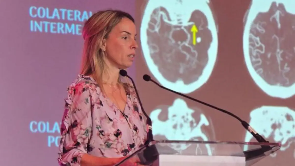 Congreso de Neurointervención plantea ruta nacional para transformar la atención del ictus