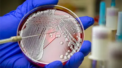 La IA logra desarrollar antibióticos eficaces contra bacterias resistentes en ratones