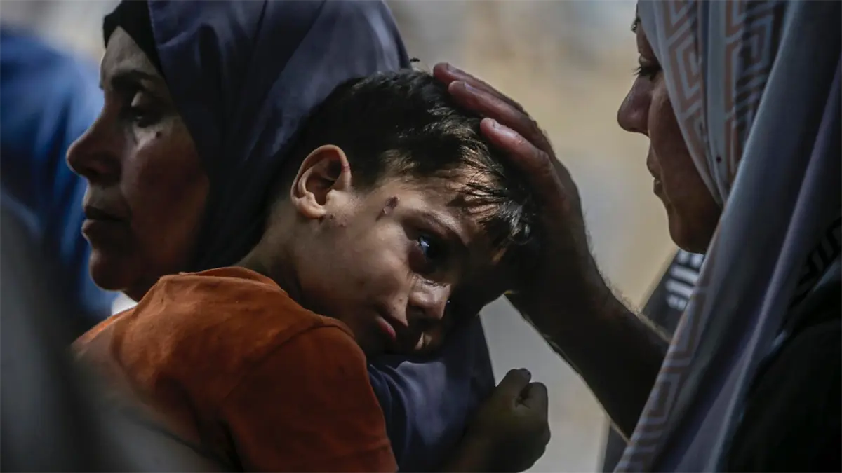 Una hora en una clínica de Gaza borra cualquier pregunta sobre la hambruna, dice Unicef