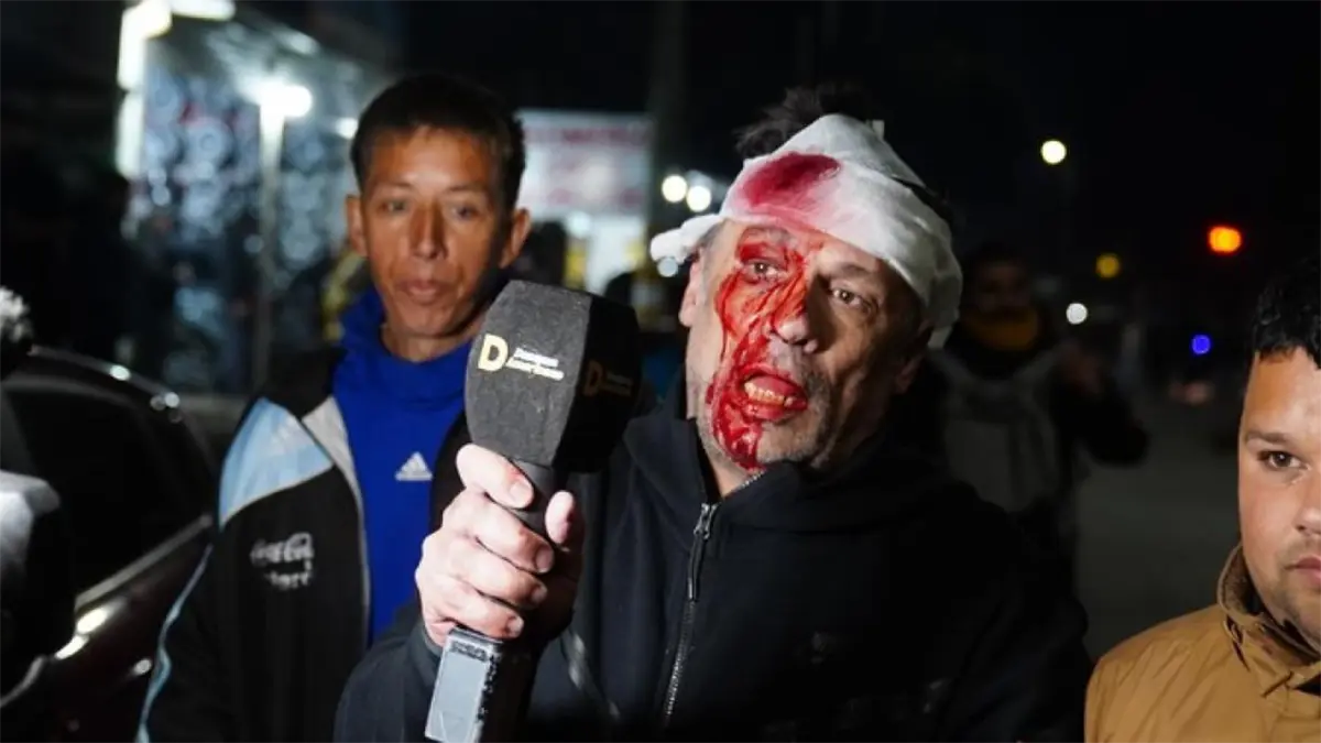 Un periodista herido en la cabeza durante el acto de campaña de Milei en Buenos Aires