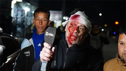 Un periodista herido en la cabeza durante el acto de campa&ntilde;a de Milei en Buenos Aires