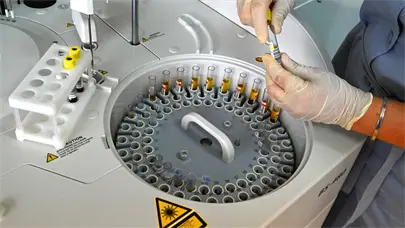 Rusia presenta su primera vacuna personalizada contra el c&aacute;ncer y espera autorizaci&oacute;n cl&iacute;nica