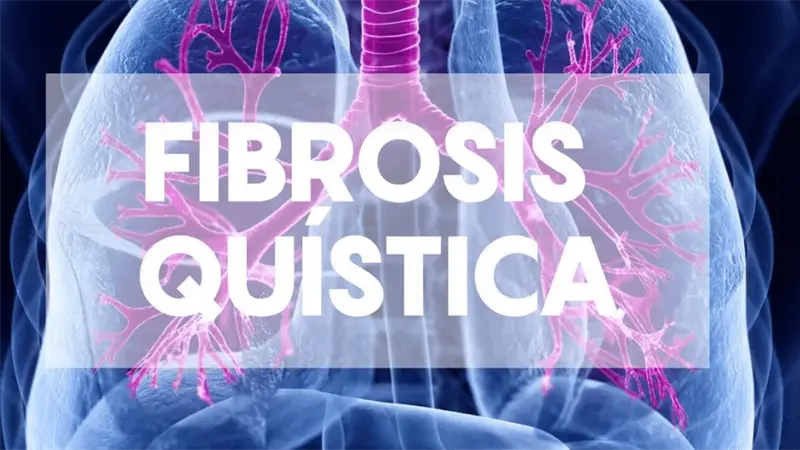 La pediatra: Fibrosis quística: ¿cuándo pensar que tu hijo puede tenerla?