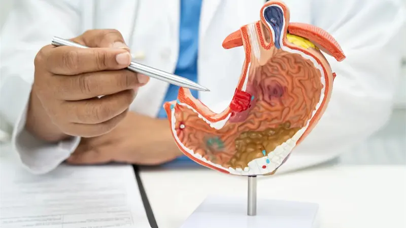 Hábitos saludables reducen riesgo de cáncer de páncreas