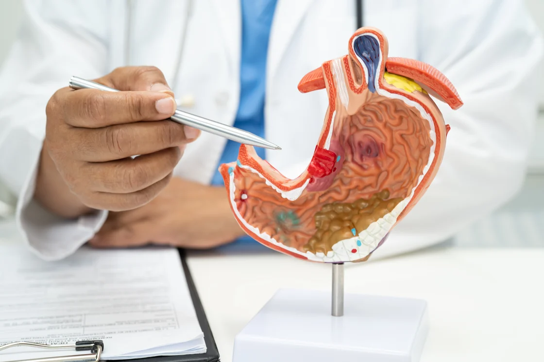 Hábitos saludables reducen riesgo de cáncer de páncreas