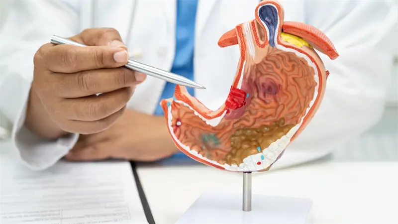 Prevenir el cáncer de páncreas es posible con hábitos saludables