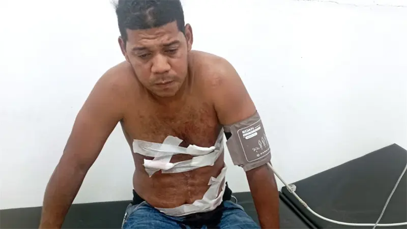 Hombre resulta herido de arma blanca durante fiestas culturales de Yamasá