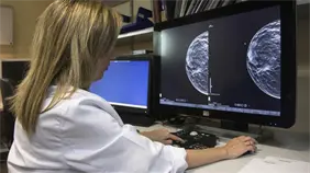 Errores en pruebas de cáncer de mama obligan a revisar casos y contactar a 2,000 mujeres en España