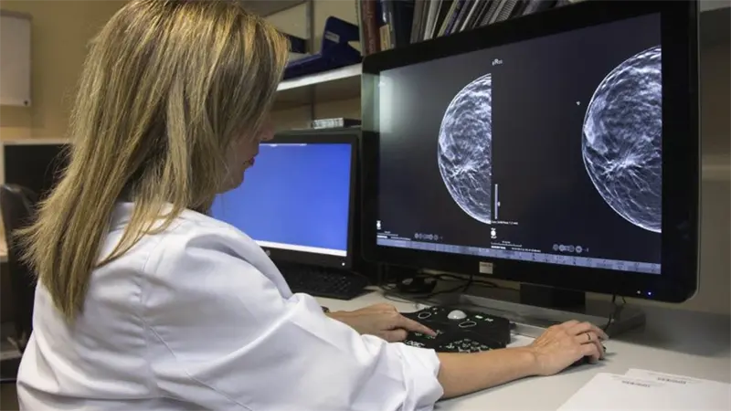 Errores en pruebas de cáncer de mama obligan a revisar casos y contactar a 2,000 mujeres en España