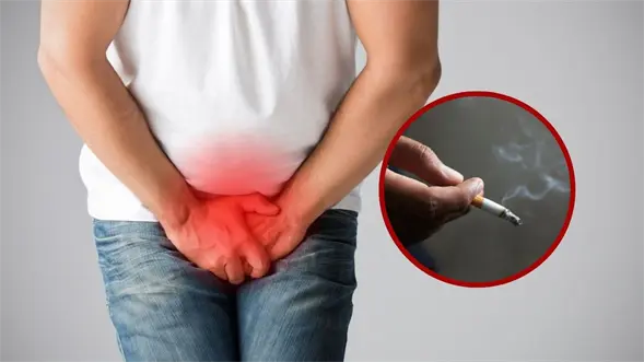 Estudio revela por qué hombres y fumadores tienen mayor riesgo de cáncer de vejiga