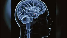 Agresión sexual afecta el cerebro con estrés postraumático