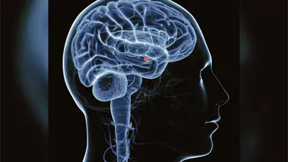 Agresi&oacute;n sexual afecta el cerebro con estr&eacute;s postraum&aacute;tico