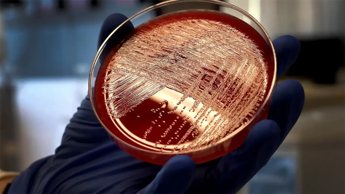 Florida prepara una lucha contra las superbacterias desde las aulas de secundaria