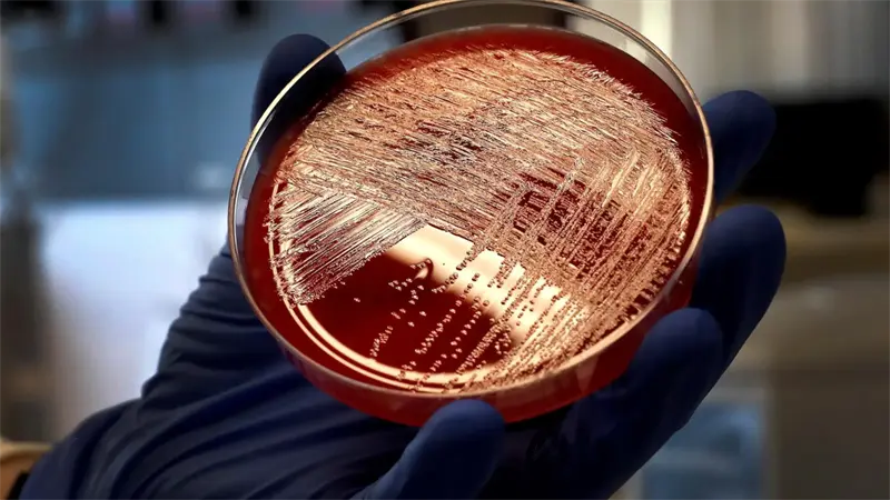 Florida prepara una lucha contra las superbacterias desde las aulas de secundaria