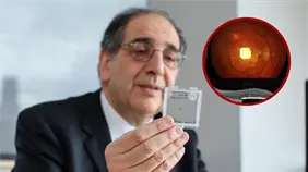 Una prótesis ocular permite leer a personas con ceguera irreversible