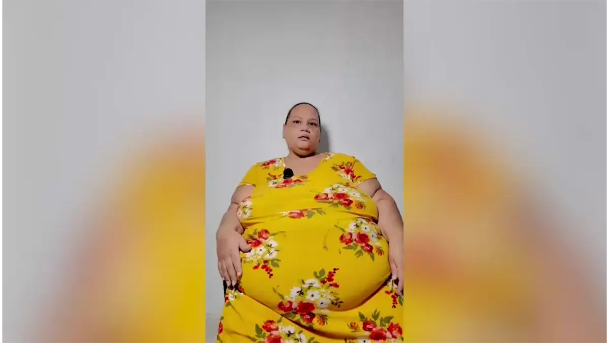 Mujer de 46 años solicita ayuda para someterse a cirugía bariátrica tras diagnóstico de diabetes