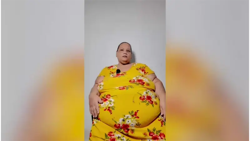Mujer de 46 años solicita ayuda para someterse a cirugía bariátrica tras diagnóstico de diabetes