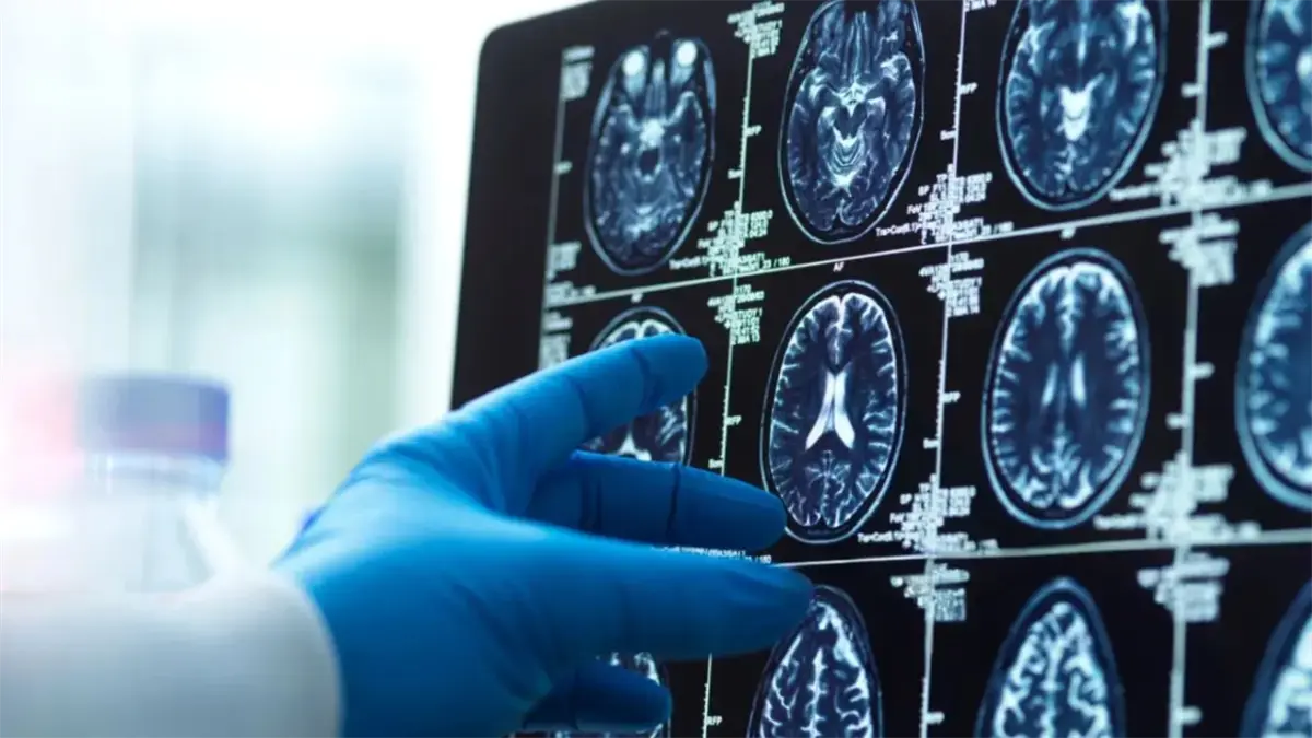 Estudio neurológico