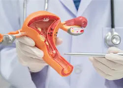 Esterilización quirúrgica: ¿una decisión definitiva que requiere reflexión?