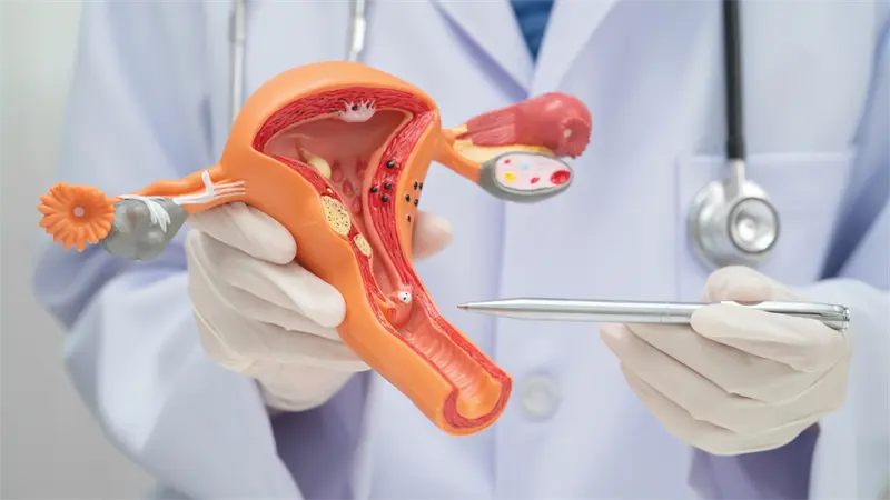 Esterilización quirúrgica: ¿una decisión definitiva que requiere reflexión?