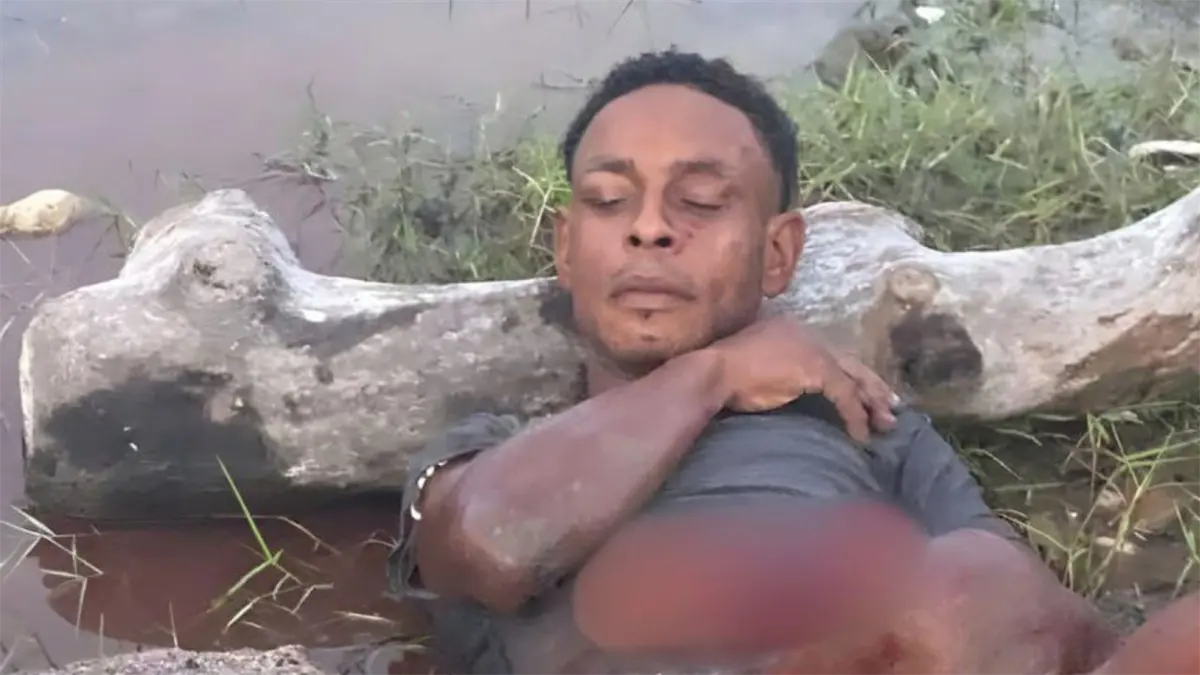 Hombre le cercena la mano y el pie a presunto asaltante que intentó robar a su familia en San Cristóbal