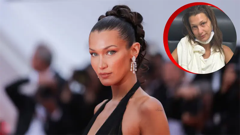 Bella Hadid rompe el silencio sobre su ansiedad médica y lucha contra la enfermedad de Lyme