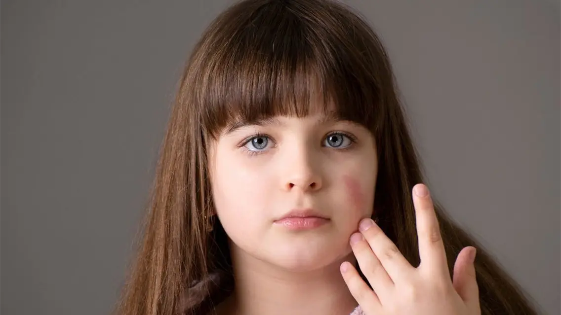 El uso en menores de un cosmético falsificado causa la muerte de tres bebés en Argelia