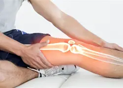 Las claves para fortalecer tus huesos de forma efectiva