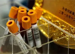 China desmantela dos redes que traficaban con muestras de sangre de mujeres embarazadas