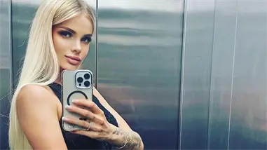 Modelo rusa queda en estado grave tras una brutal paliza de su novio