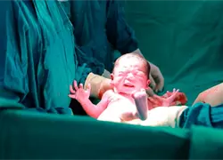 Los partos por ces&aacute;rea superan por primera vez a los naturales en Inglaterra
