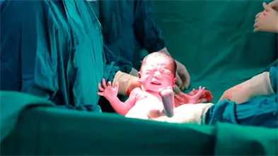 Los partos por cesárea superan por primera vez a los naturales en Inglaterra