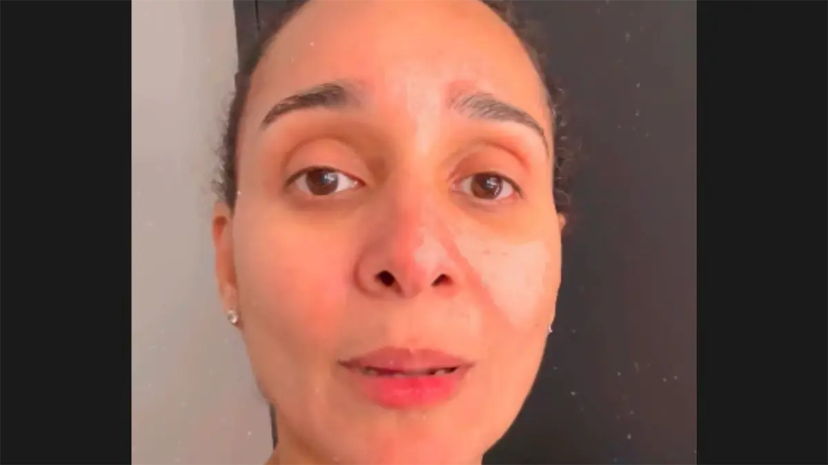 Mujer dice figura con procedimientos médicos en Senasa pese a llevar 15 años viviendo fuera del país