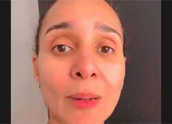 Mujer dice figura con procedimientos m&eacute;dicos en Senasa pese a llevar 15 a&ntilde;os viviendo fuera del pa&iacute;s