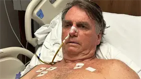 Bolsonaro pasa por una tercera intervenci&oacute;n quir&uacute;rgica para controlar las crisis de hipo