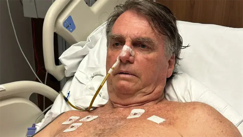 Bolsonaro pasa por una tercera intervención quirúrgica para controlar las crisis de hipo