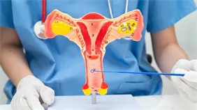 &iquest;Qu&eacute; es la miomectom&iacute;a laparosc&oacute;pica y cu&aacute;les son sus beneficios?