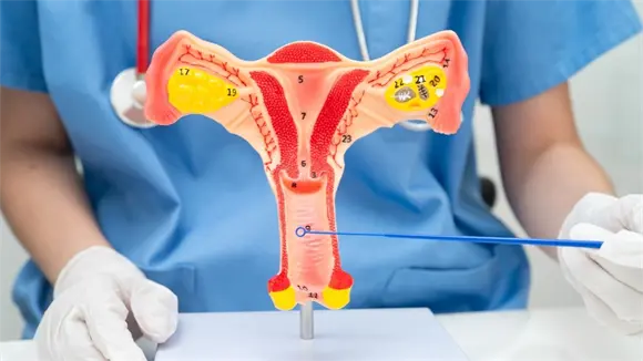 ¿Qué es la miomectomía laparoscópica y cuáles son sus beneficios? ¿Qué es la miomectomía laparoscópica y cuáles son sus beneficios?