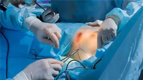 Cirujano impulsa la mamoplastia de reducción como cirugía de salud en la República Dominicana Cirujano impulsa la mamoplastia de reducción como cirugía de salud en la República Dominicana