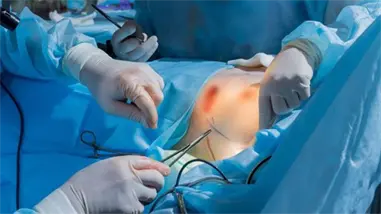 Cirujano impulsa la mamoplastia de reducci&oacute;n como cirug&iacute;a de salud en la Rep&uacute;blica Dominicana