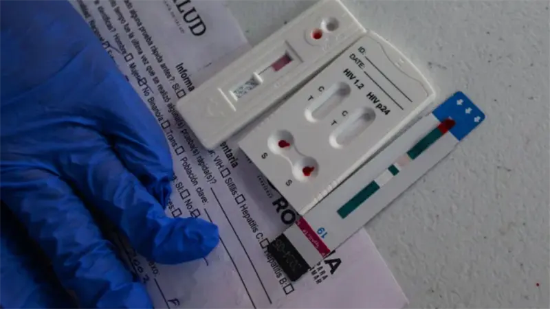 Costa Rica autoriza autopruebas de VIH para fortalecer la detecci&oacute;n temprana
