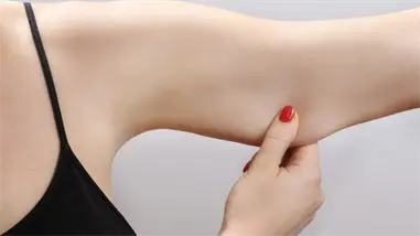 &iquest;C&oacute;mo eliminar la grasa ubicada en la parte posterior del brazo?