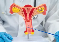 Papanicolaou: clave para la detecci&oacute;n temprana y cuidado de la salud femenina