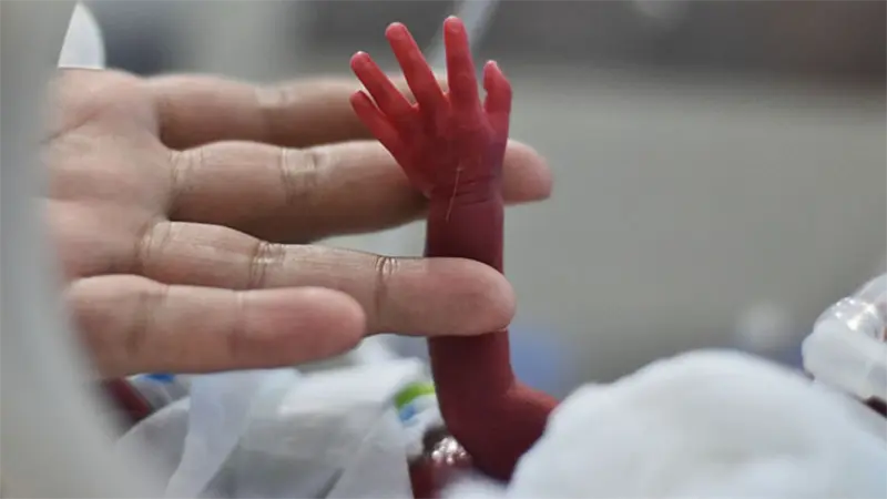 Demuestran los beneficios de transfundir sangre de cord&oacute;n umbilical a prematuros extremos